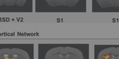 Functional imaging of the CNS