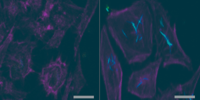 Biomolecule-nanomaterial hybrids technological